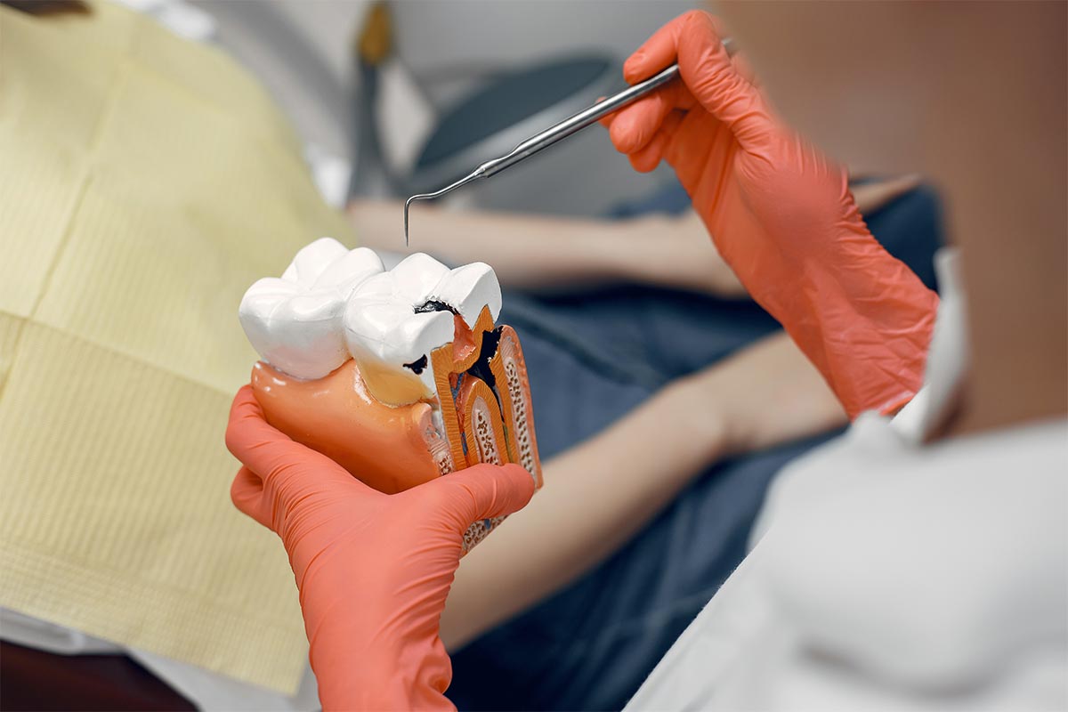 Single Sitting Root Canal Treatment